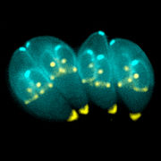 180px-Toxoplasma_gondii