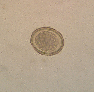 Ascaris_lumbricoides